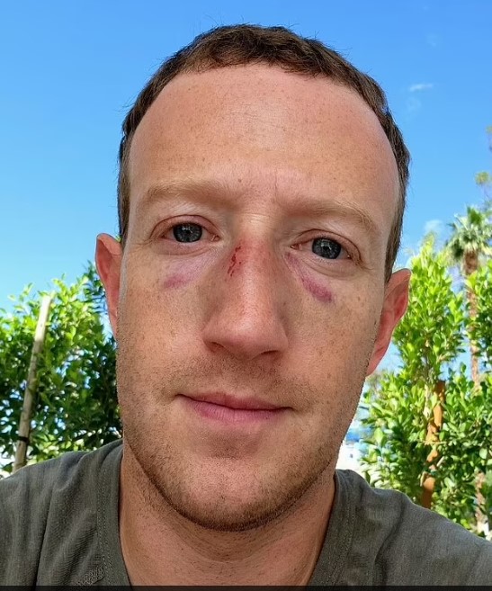 Mark Zuckerberg bị đấm sưng mắt sau buổi tập MMA - Ảnh 1