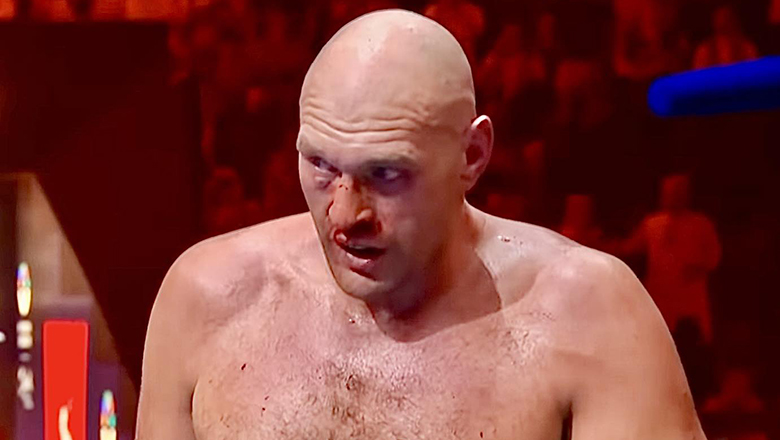 Tyson Fury tin mình mới là người thắng Usyk - Ảnh 1