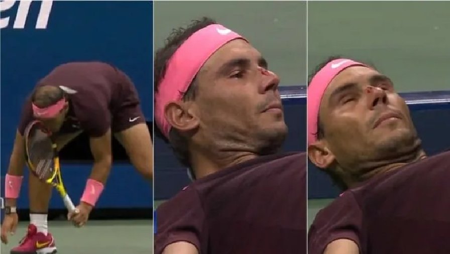 Nadal đổ máu giữa trận gặp Fognini ở US Open 2022
