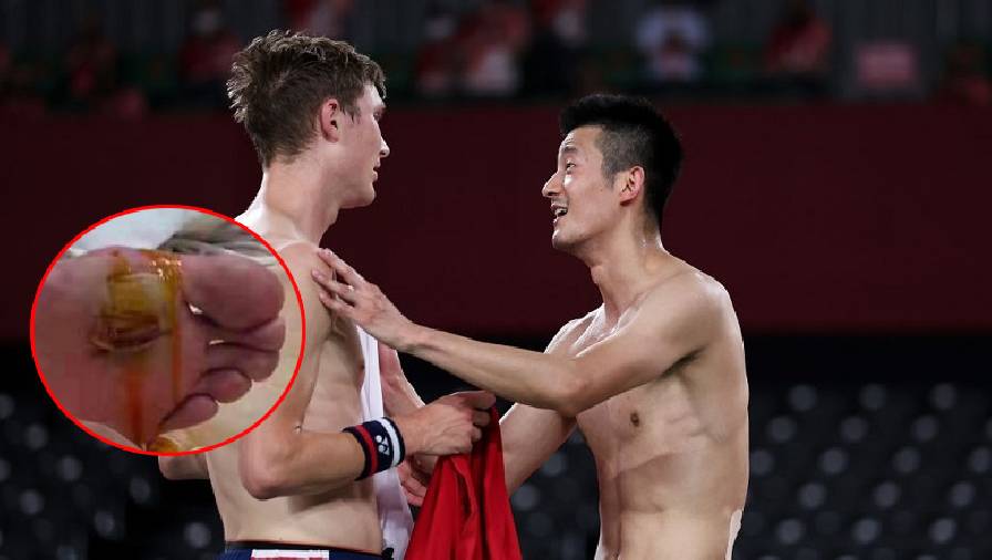 Bàn chân phồng rộp, chảy máu, Chen Long vẫn ra sân đấu chung kết cầu lông Olympic Tokyo 2021