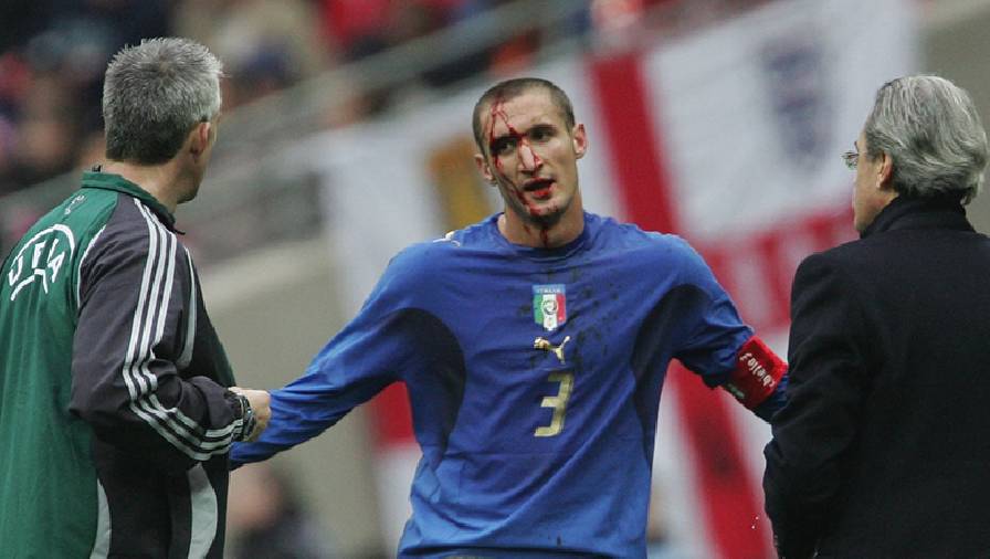 Chiellini từng vỡ đầu khi gặp Anh trong ngày khai trương sân Wembley