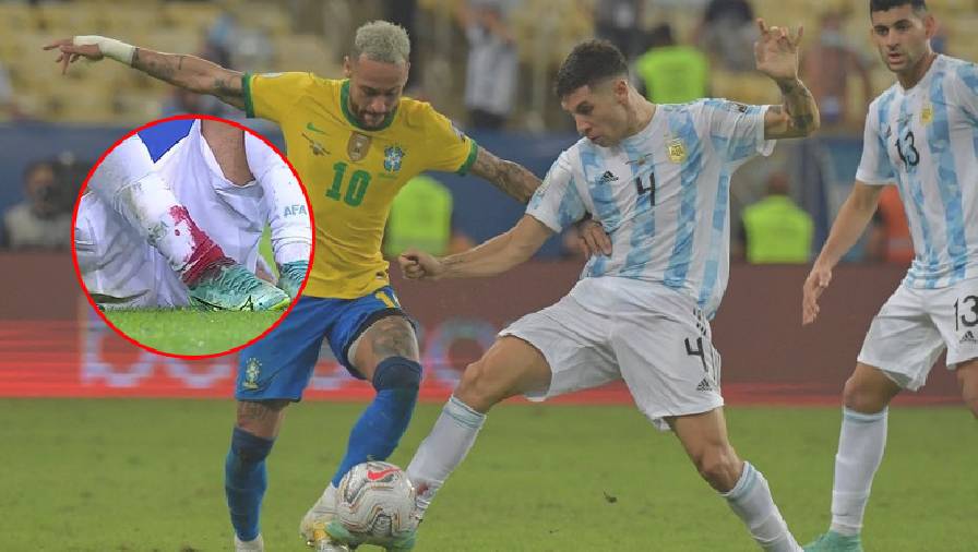 Hậu vệ Argentina đổ máu, đỏ thẫm cả tất trong trận chung kết Copa America