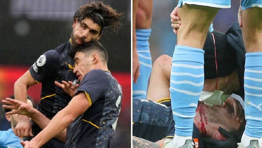 Cầu thủ Wolves chảy máu đầm đìa sau pha va chạm với đồng đội ở trận gặp Man City
