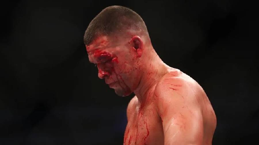Dana White không biết phải làm gì với Nate Diaz sau trận thua tại UFC 263
