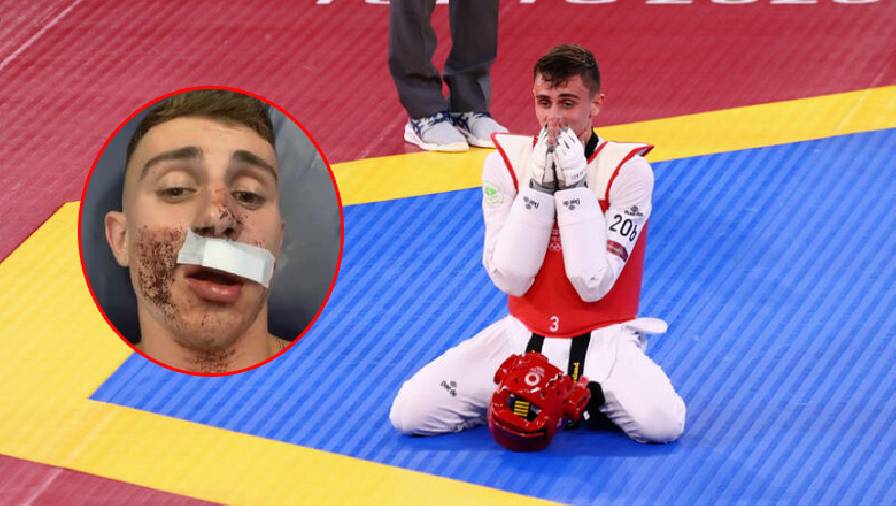 Võ sĩ Taekwondo gây sốt ở Olympic Tokyo 2021 bị đấm gãy răng trên đường phố