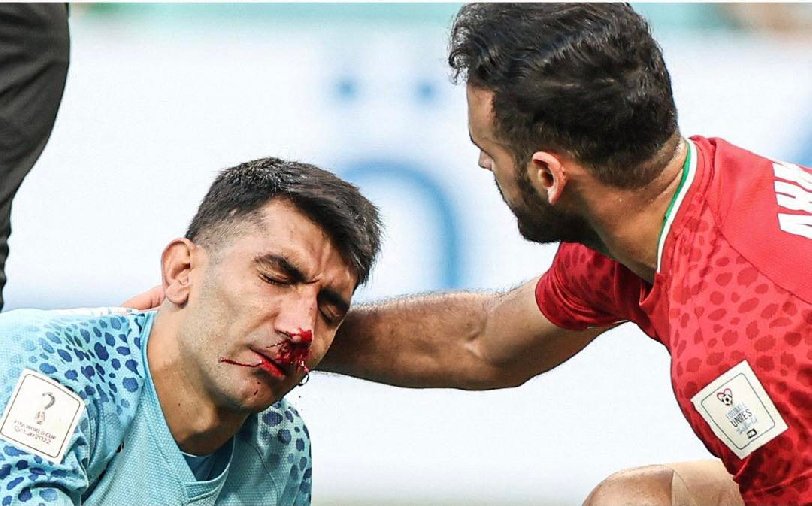 Thủ môn ĐT Iran đổ máu sau pha va chạm với đồng đội, nằm sơ cứu 10 phút rồi rời sân bằng cáng