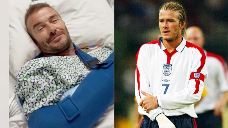 David Beckham phải phẫu thuật vì vết đau khi phục vụ ĐT Anh cách đây... 22 năm