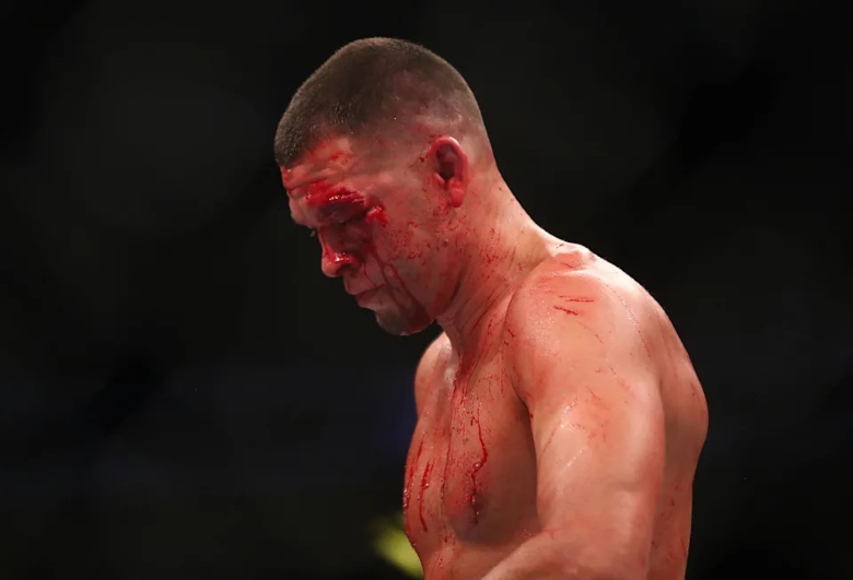 Dana White không biết phải làm gì với Nate Diaz sau trận thua tại UFC 263 - Ảnh 1