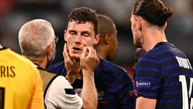 UEFA ra kết luận về nghi vấn sao Pháp chấn động não trong trận gặp Đức - Ảnh 2