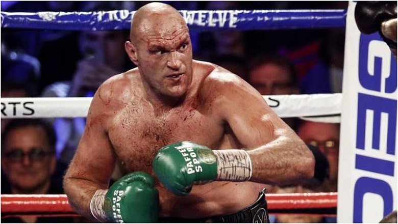Tyson Fury sẽ bảo vệ danh hiệu vô địch WBC trước Dillian Whyte sau nhiều lần né tránh - Ảnh 2