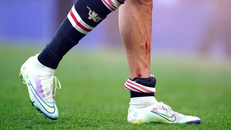 Ronaldo rách chân ở trận MU thua Everton - Ảnh 1
