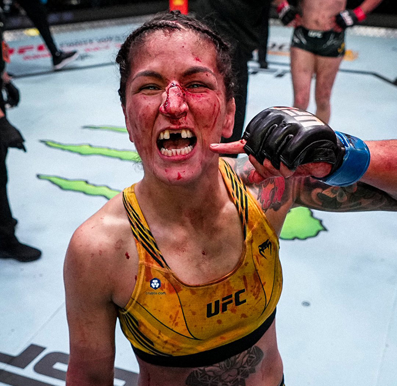 Sao nữ UFC vỡ mũi, gãy 2 răng cửa sau chiến thắng ở sự kiện 'Fight Night' - Ảnh 1