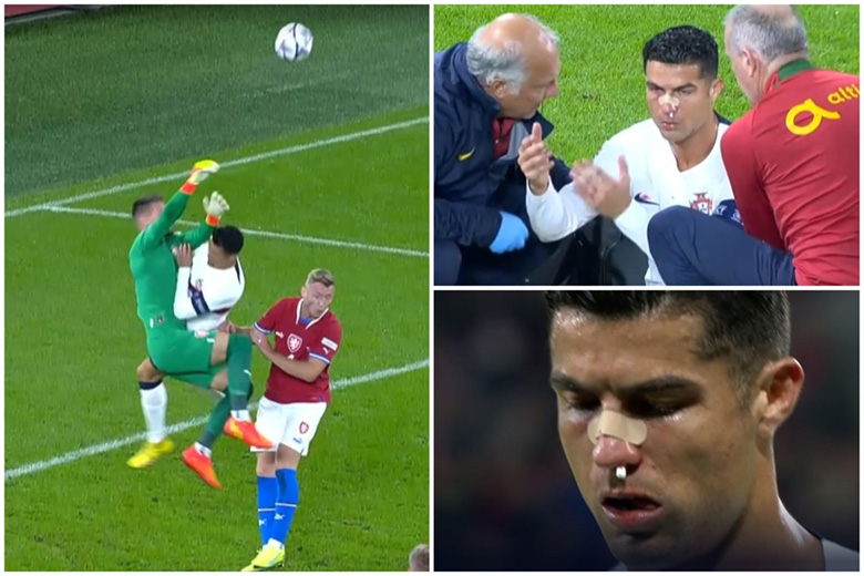 Ronaldo bị thủ môn đấm đổ máu ở trận Bồ Đào Nha thắng CH Séc - Ảnh 1