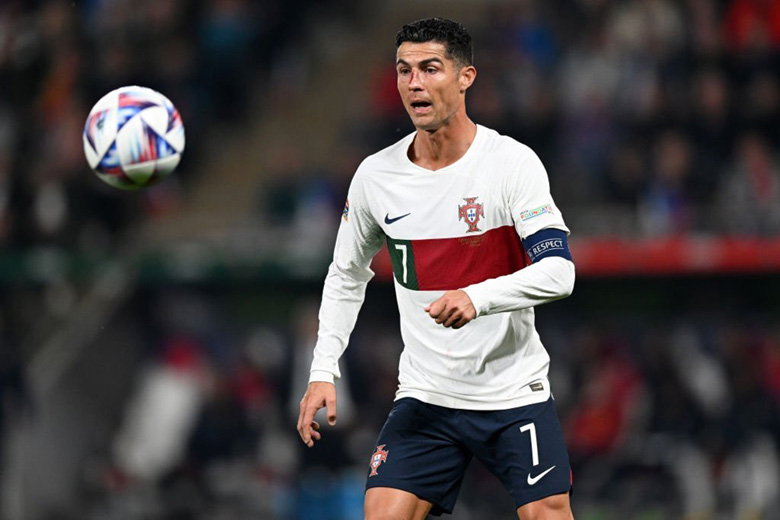 Ronaldo bị thủ môn đấm đổ máu ở trận Bồ Đào Nha thắng CH Séc - Ảnh 3