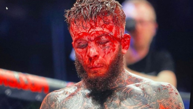 Jordan Vucenic mặt đẫm máu, biến dạng sau trận đấu ở giải MMA Cage Warriors - Ảnh 2