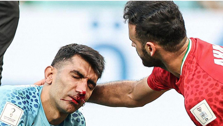 Thủ môn ĐT Iran đổ máu sau pha va chạm với đồng đội, nằm sân 10 phút rồi rời sân bằng cáng - Ảnh 1