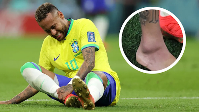 Neymar chấn thương, rơi nước mắt sau khi rời sân - Ảnh 1